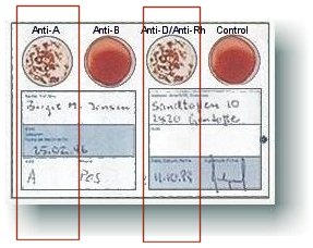 Blood Typing