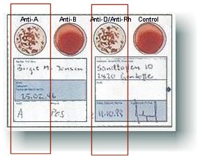 Blood Type Test, Determine Blood Type