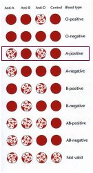 Blood Type Chart